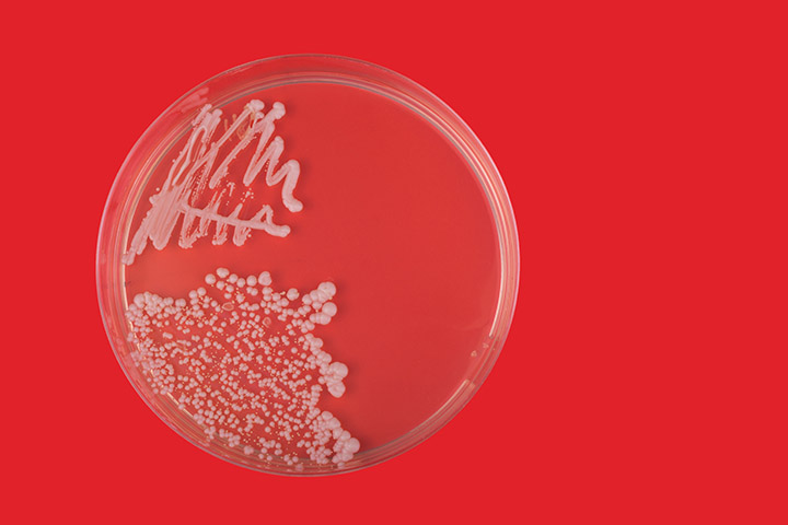 Placa de Petri com Candida albicans