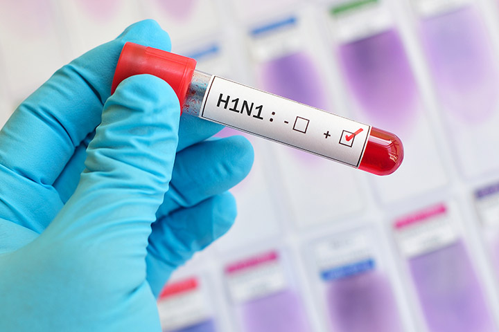 H3N2: como diferenciar de Covid?