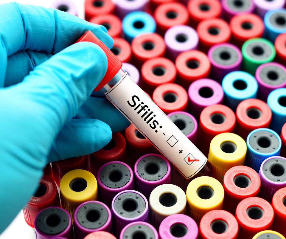 Sífilis: o que é, sintomas e tratamentos
