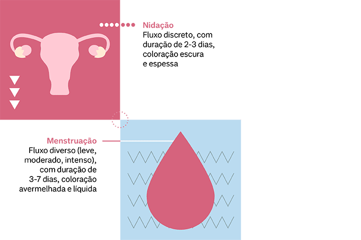 Qual a diferença entre nidação e menstruação? - Significados