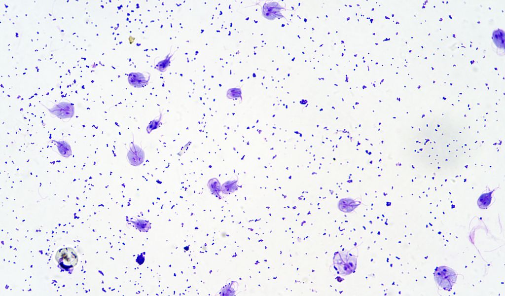 Giardíase sintomas, transmissão e tratamento Blog Nav Dasa