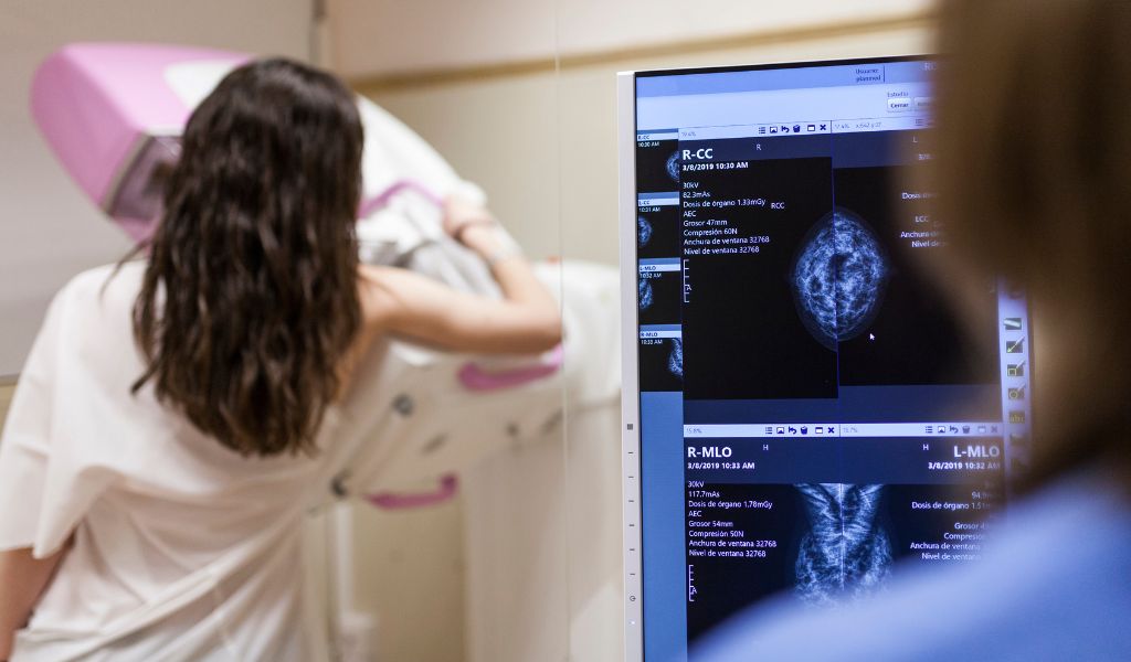 Mamografia digital: o que é, como é feita, preparação e vantagens
