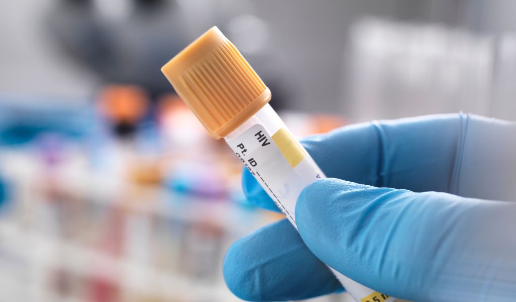Teste de HIV: tipos de exame, como são feitos e quem deve fazer 