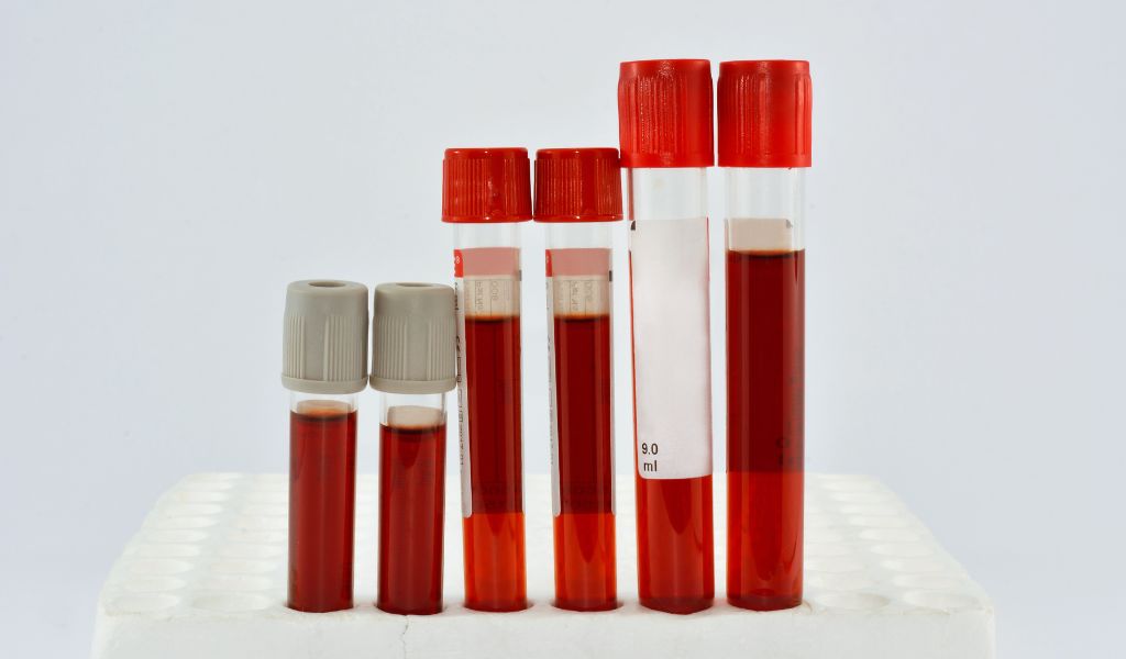 Proteína C Reativa: níveis elevados podem indicar inflamações ou infecções