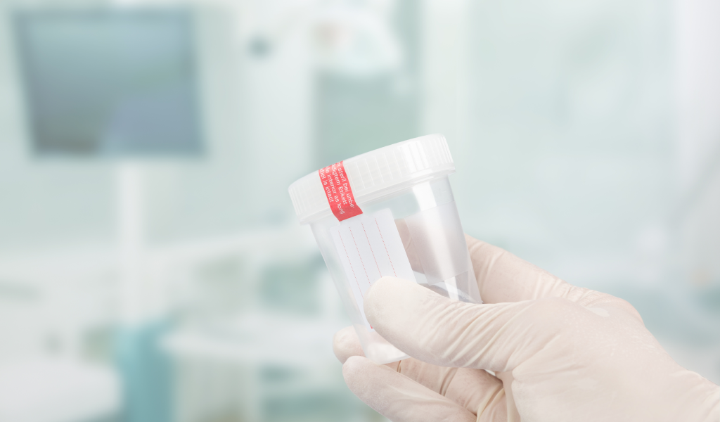 Coprocultura: como funciona e quando realizar no diagnóstico de infecções