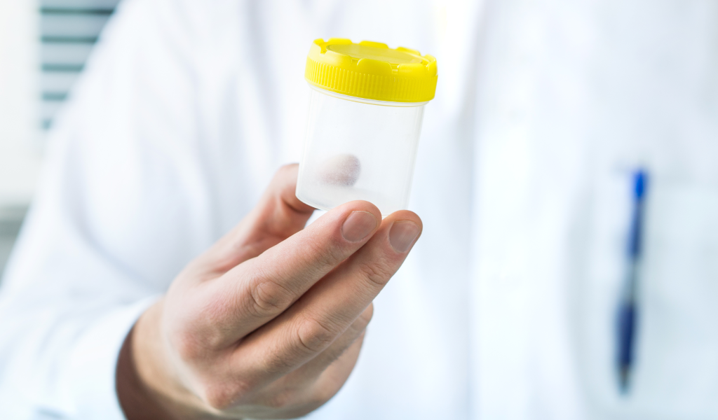 Microalbuminuria