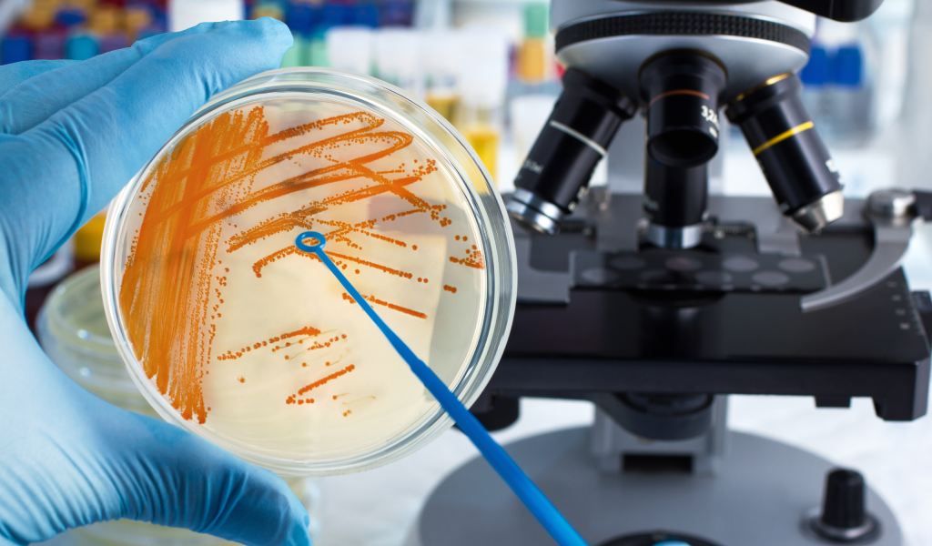 Streptococcus agalactiae