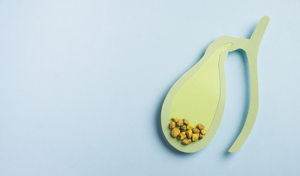 Pedra na vesícula nem sempre causa sintomas; entenda o problema e formas de tratamento